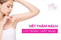 HẾT THÂM NÁCH CHỈ TRONG 1 NỐT NHẠC